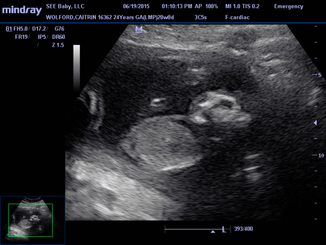 10407677_900069953387799_7072719914479444608_n