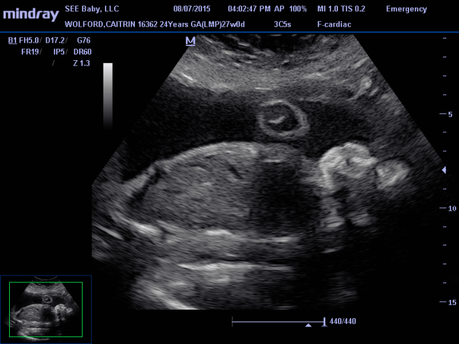 11220846_909770215751106_2957804900740871137_n