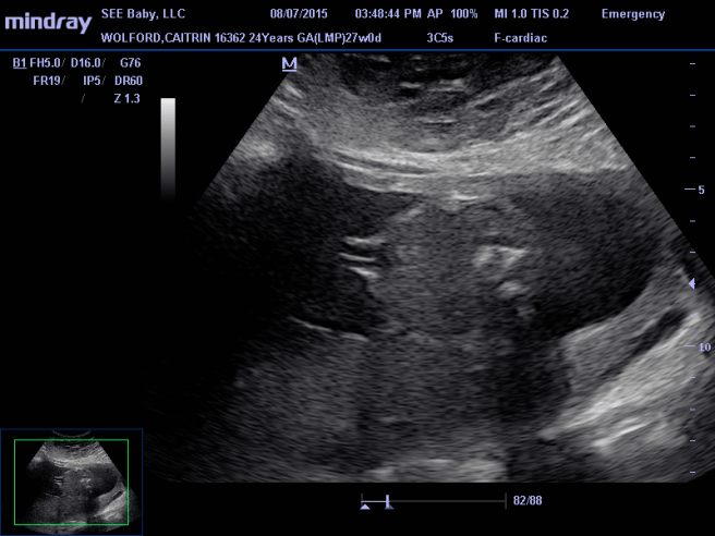 11836858_909770192417775_8861440584427432375_n